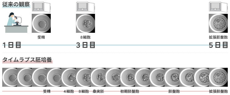 タイムラプス胚培養（先進医療）